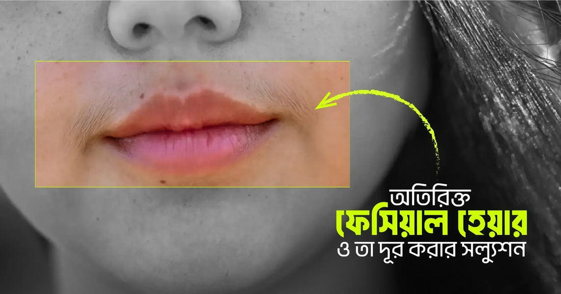 অতিরিক্ত ফেসিয়াল হেয়ার ও তা দূর করার সল্যুশন