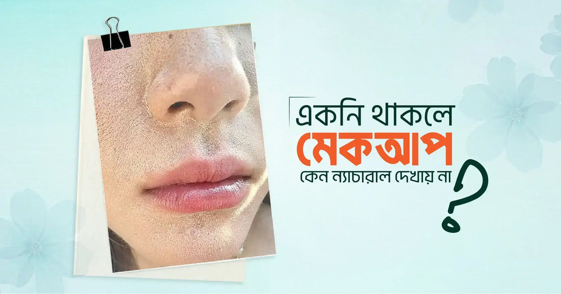 একনি থাকলে মেকআপ কেন ন্যাচারাল দেখায় না